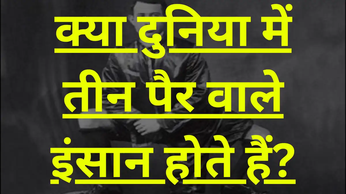 क्या दुनिया में तीन पैर वाले इंसान होते हैं?