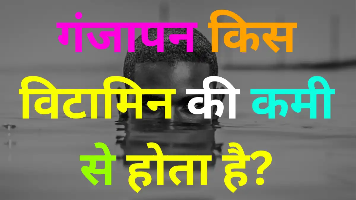 GK Quiz In Hindi: गंजापन किस विटामिन की कमी से होता है?